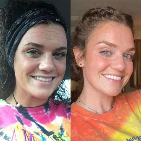 HoneyPeel™ - 
Silicone Scar Sheets