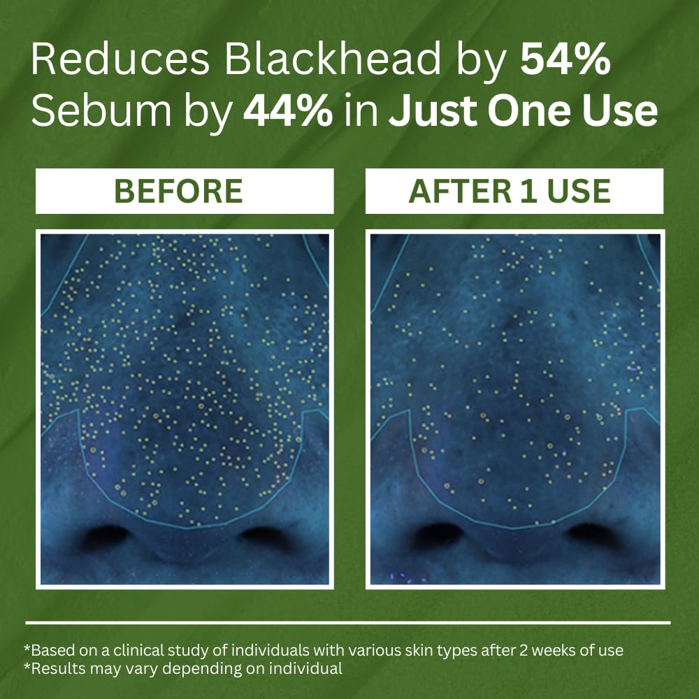 Holy Basil Bubble Cleansing Mask