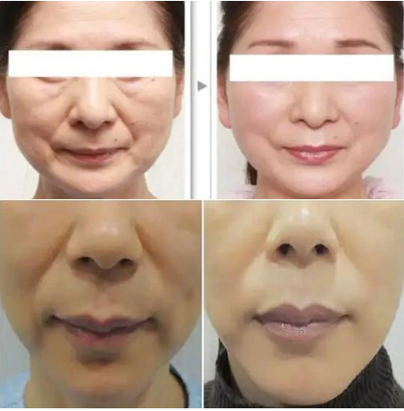 COLLAGEN THREAD WITH 24K GOLD SERUM